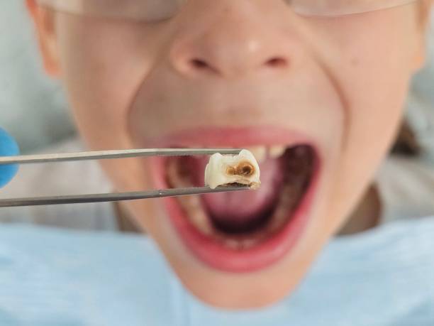 Best Emergency Pediatric Dental Care in Upper Sandusky, OH