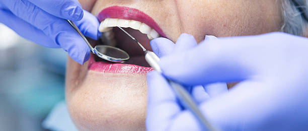 Best Weekend Emergency Dental Services in Upper Sandusky, OH